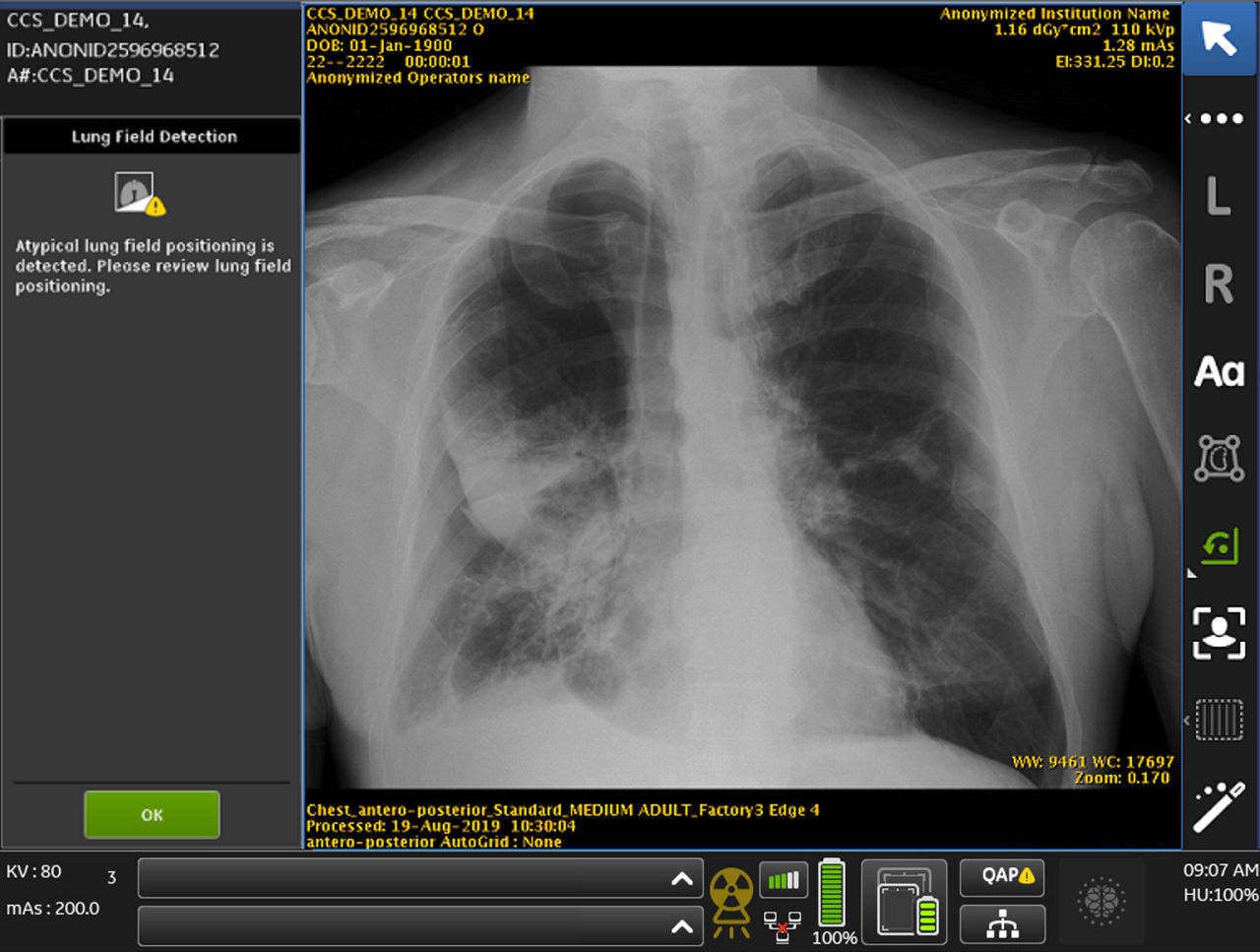 Case14-Processed-noPM-LC-popup-PTX