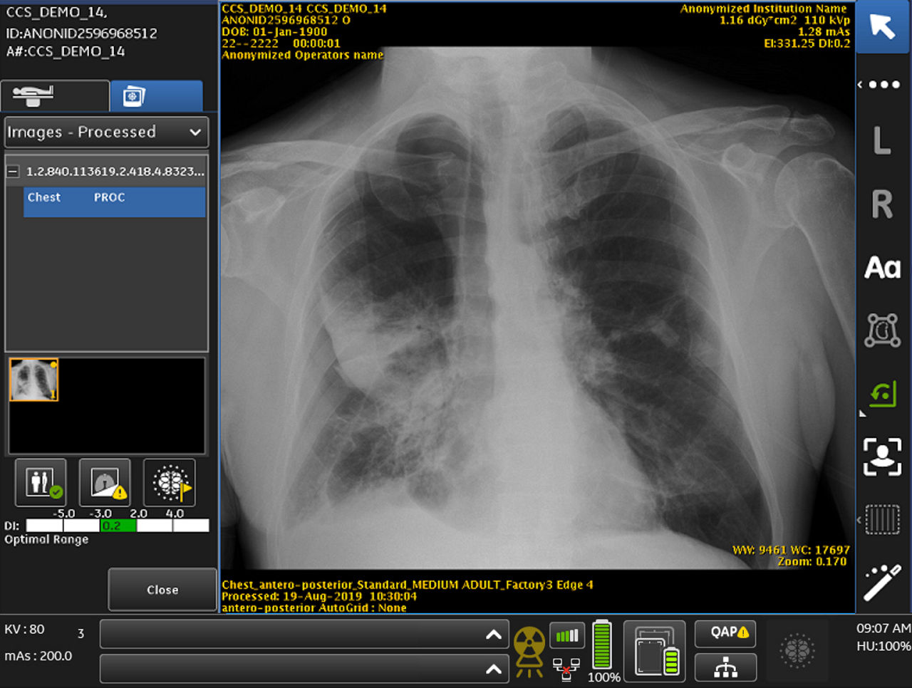 Case14-Processed-noPM-LC-PTX