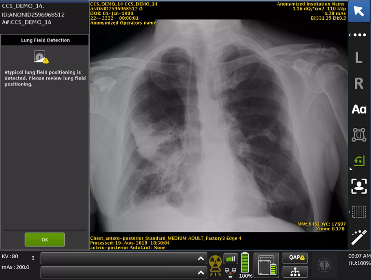 Case14_Processed_noPM_LC-popup_PTX