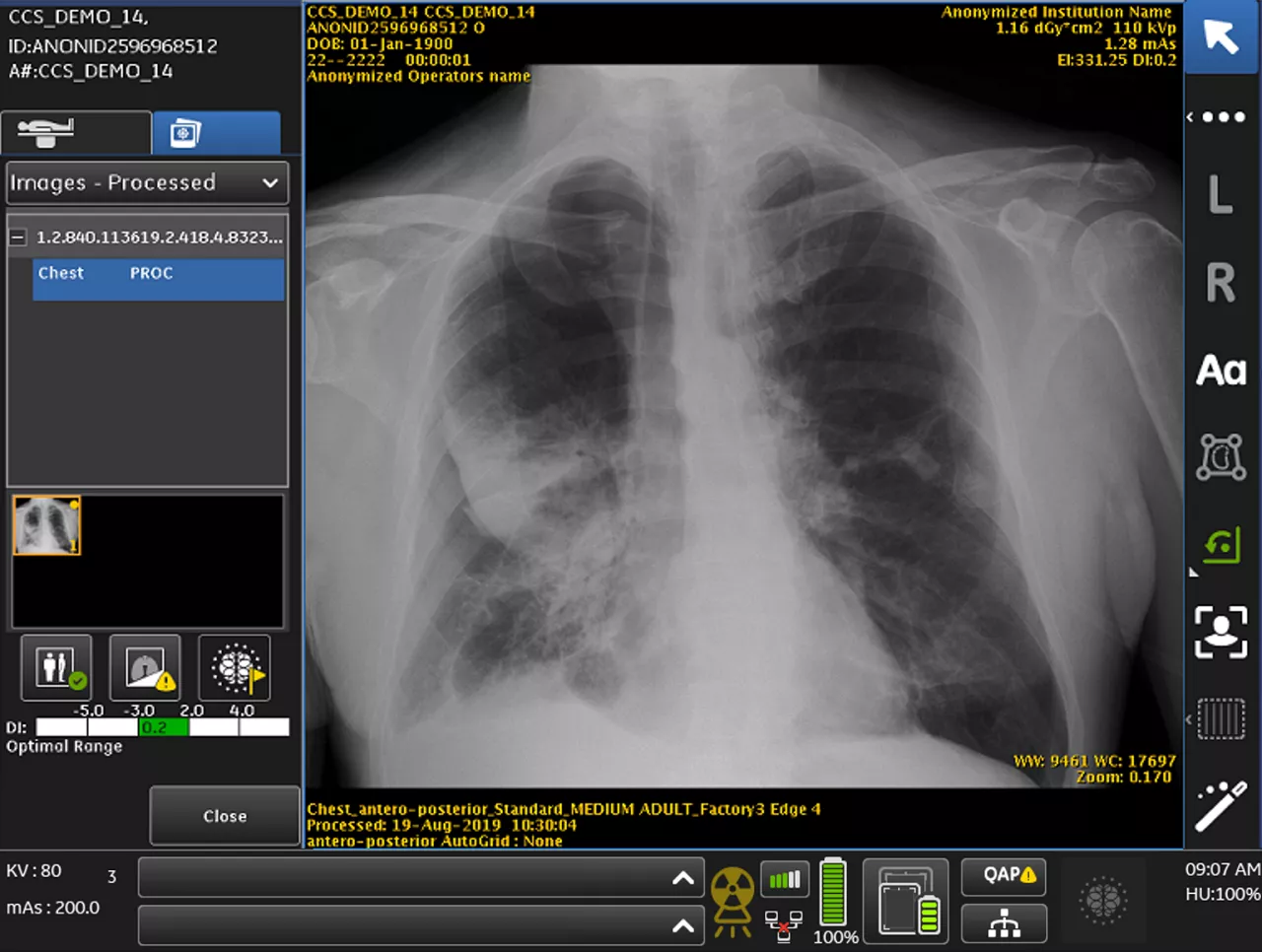 Case14_Processed_noPM_LC_PTX