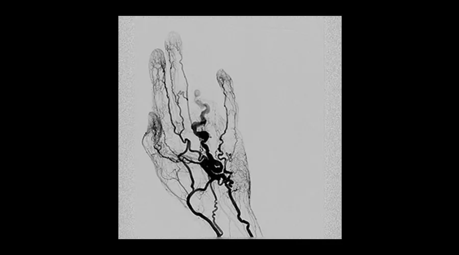 categories-interventional-x-ray-igs-for-interventional-cardiology-330-hand-avm