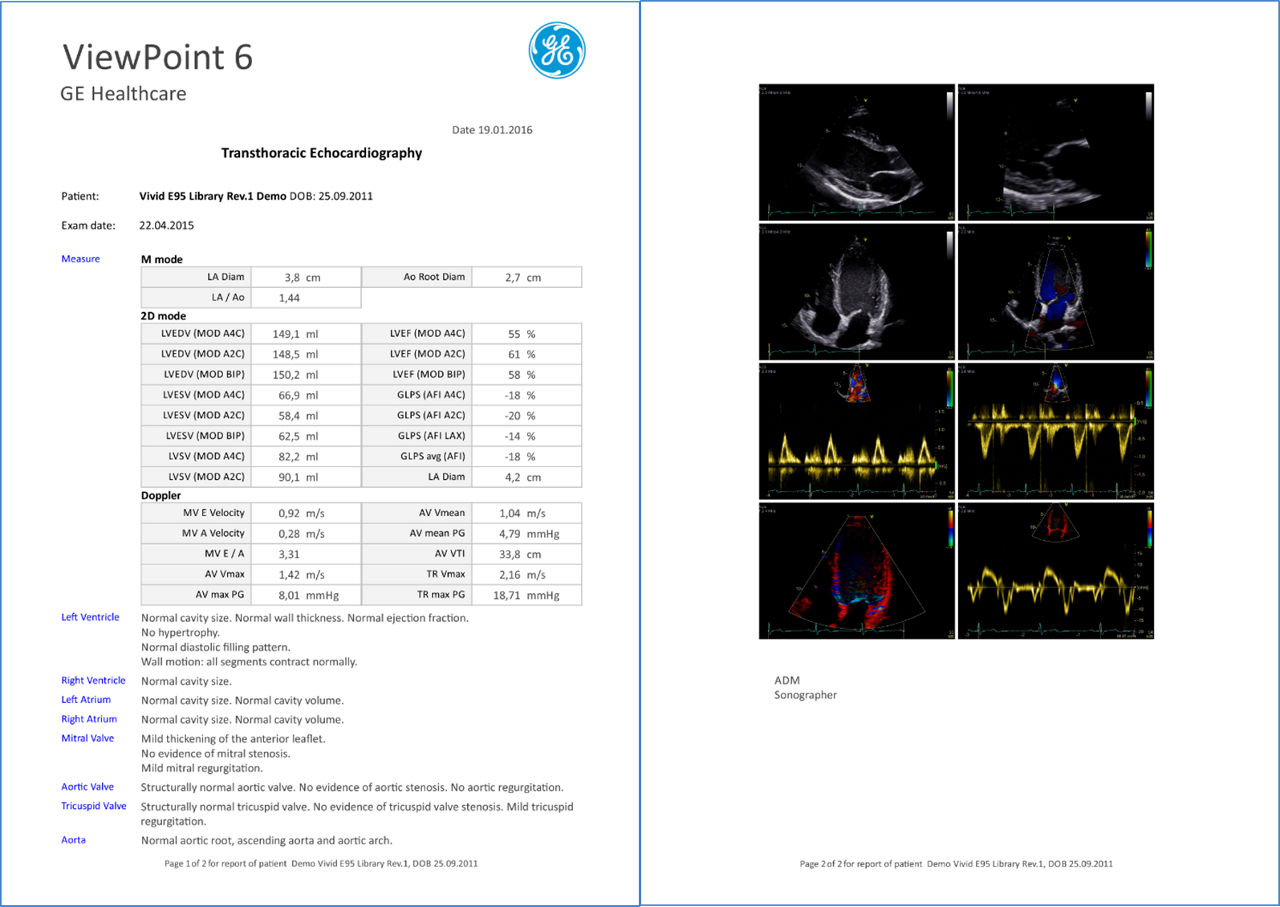 categoriesultrasoundultrasounditviewpoint-for-echopac-and-new-suitereportingtabpng