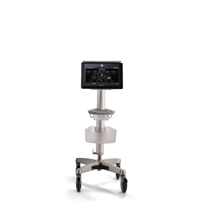 A Point of Care Ultrasound System