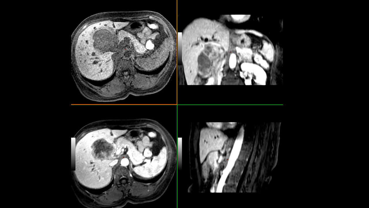 ced-visualization-applications-readyview-aw-readyview-clinical-image-advanced-average