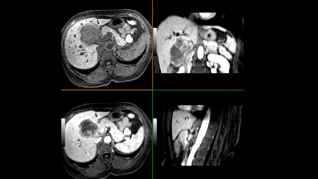 ced-visualization-applications-readyview-aw-readyview-clinical-image-advanced-average