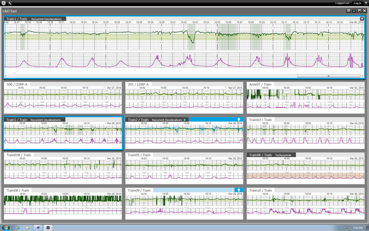 centricity-perinatal-software-survaillance-ci-en