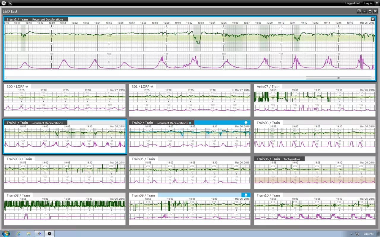 centricity-perinatal-software-survaillance-ci-en