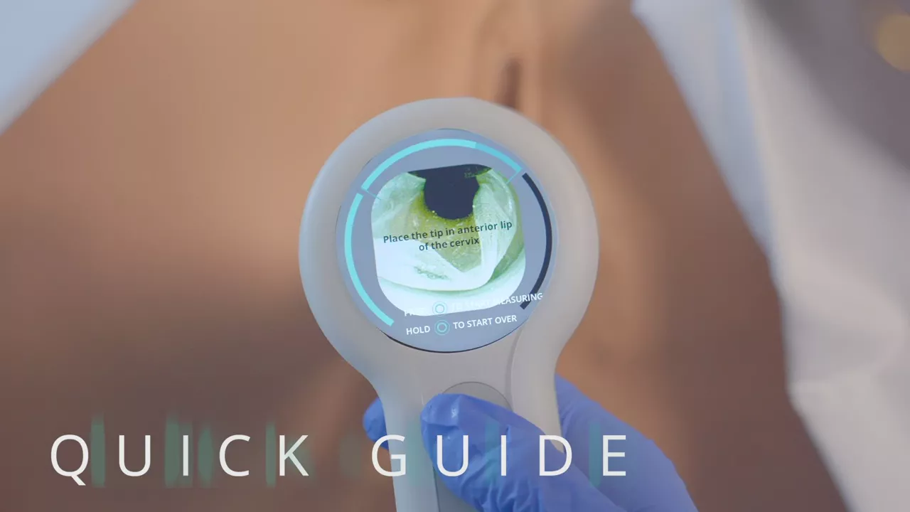 cervisense-quick-guide