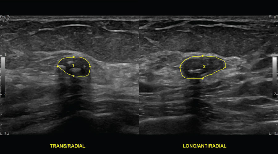 Clinical-Image---Breast-Mass-900x500