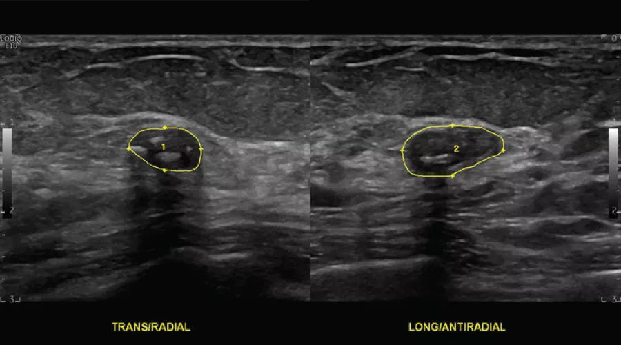 Clinical-Image---Breast-Mass-900x500