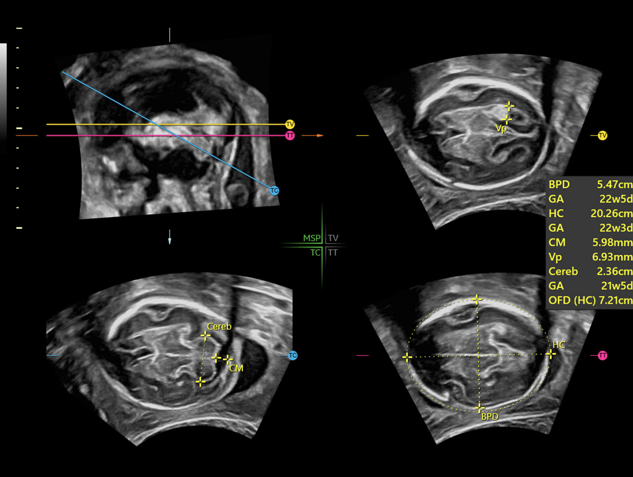 Clinical-Image-of-SonoCNS