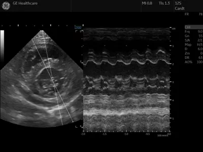 clinical-image5
