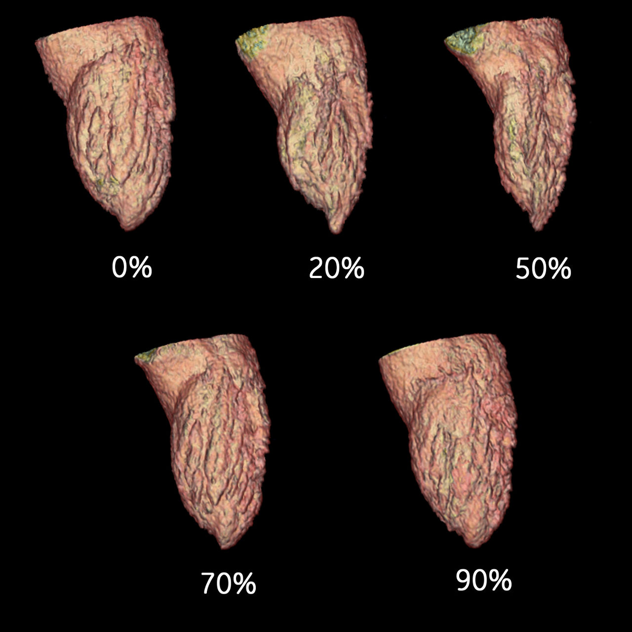 clinical images-cardiac-gehc-revolution-ct-cardiac-cinical_coronary_function_analysis2.jpg