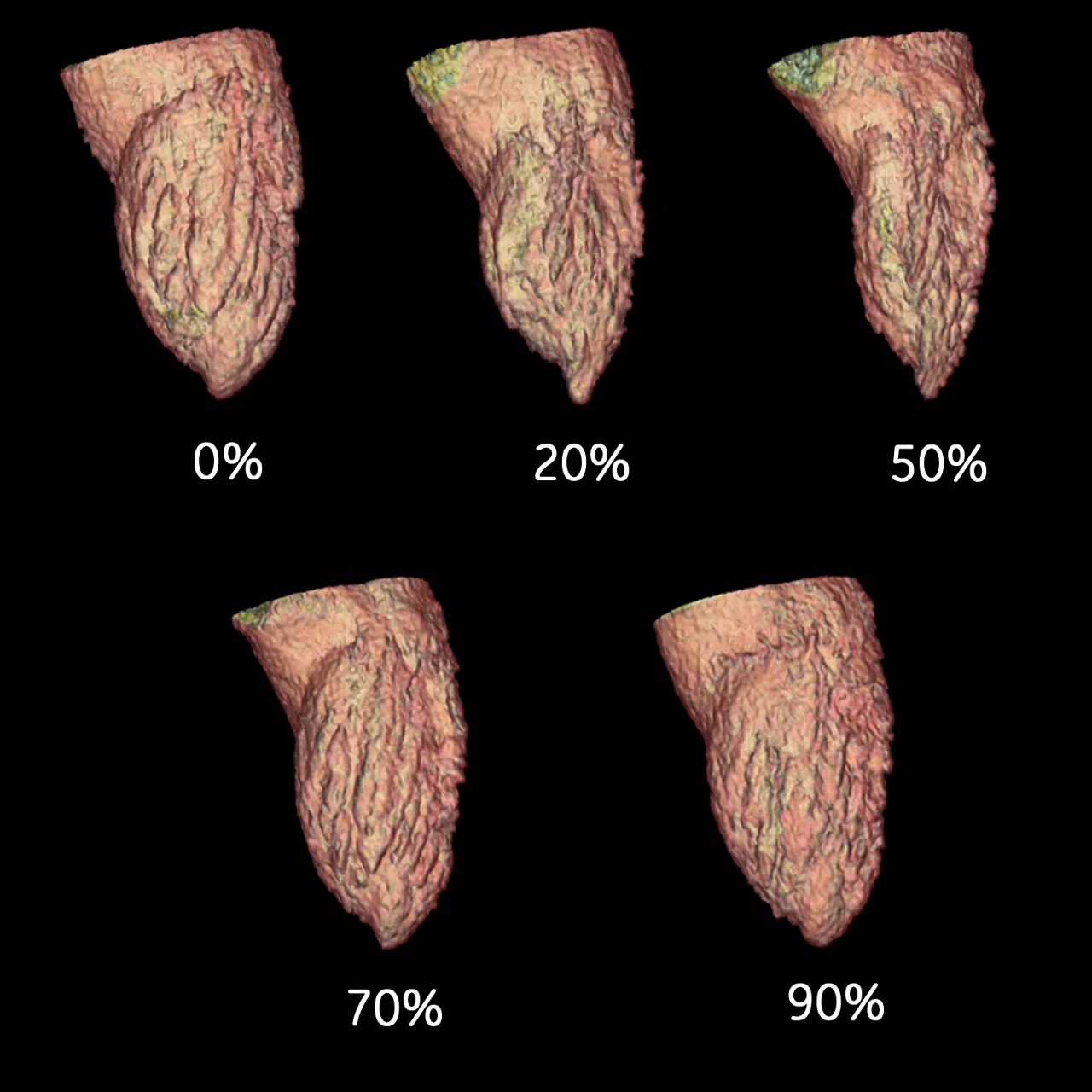 clinical images-cardiac-gehc-revolution-ct-cardiac-cinical_coronary_function_analysis2.jpg