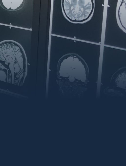 cns-brain-desktop