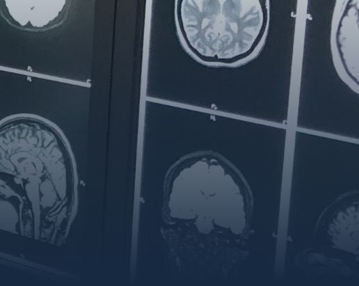 cns-brain-desktop-en