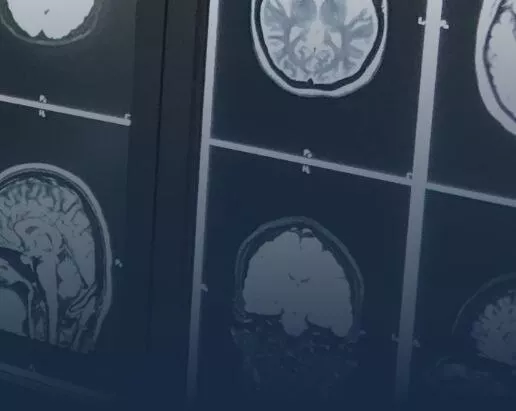 cns-brain-desktop-en