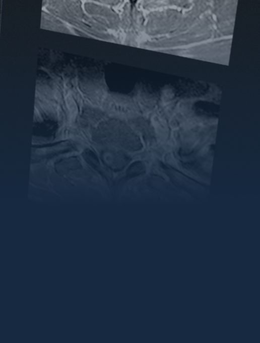 cns-spine-desktop