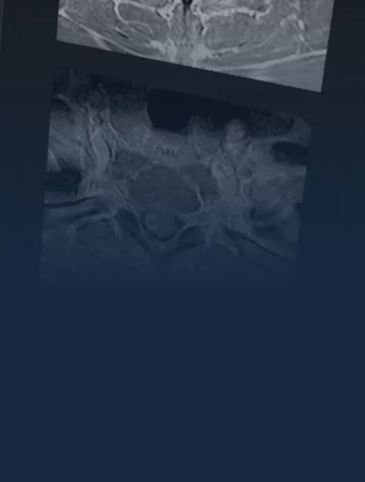 cns-spine-desktop