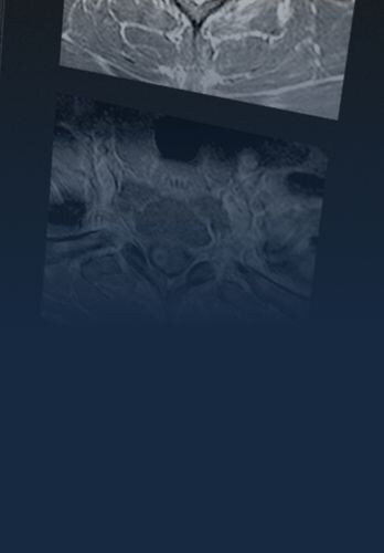 cns-spine-tablet