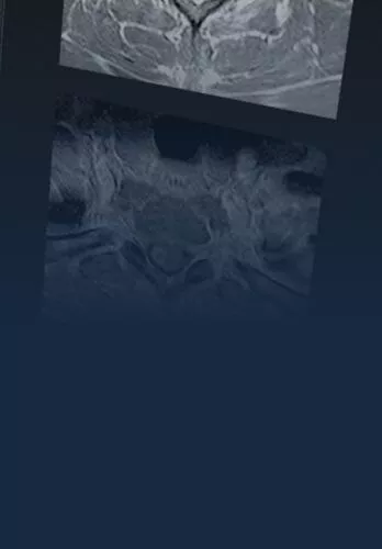 cns-spine-tablet