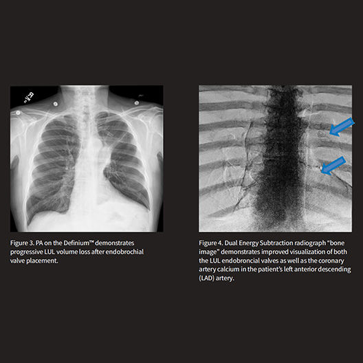 collection-carousel-advanced-xray-desktop