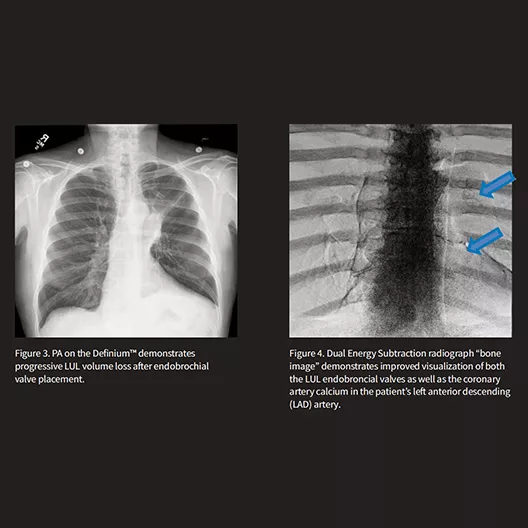 collection-carousel-advanced-xray-desktop