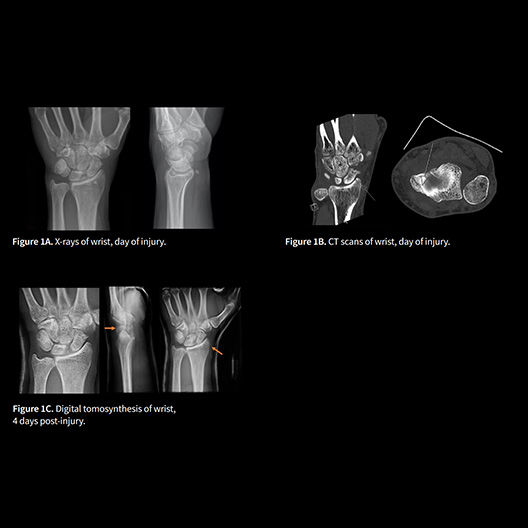 collection-carousel-clinical-utility-desktop