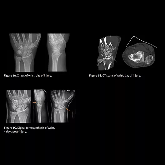 collection-carousel-clinical-utility-desktop