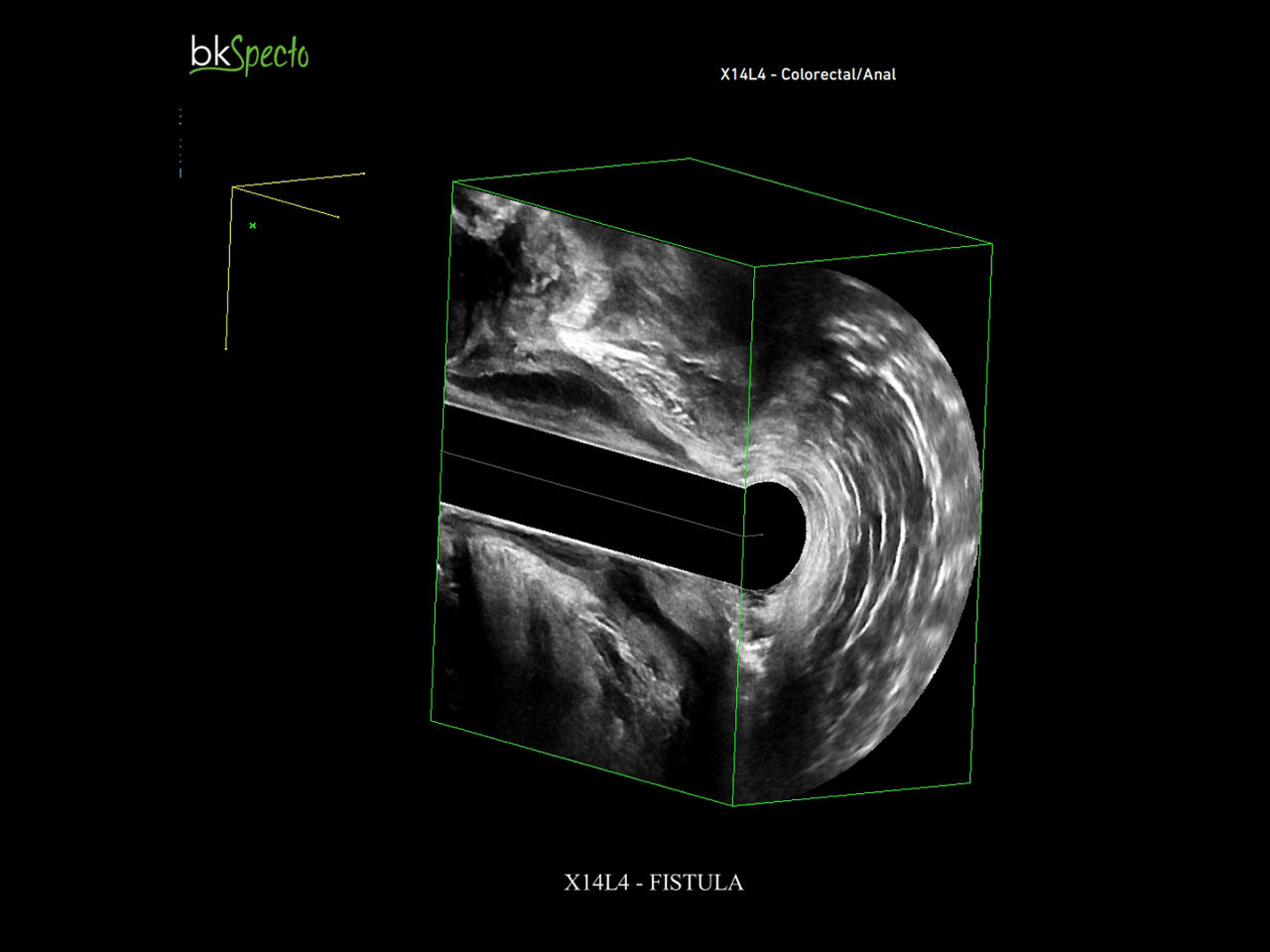 colorectal-surgery-imaging-desktop