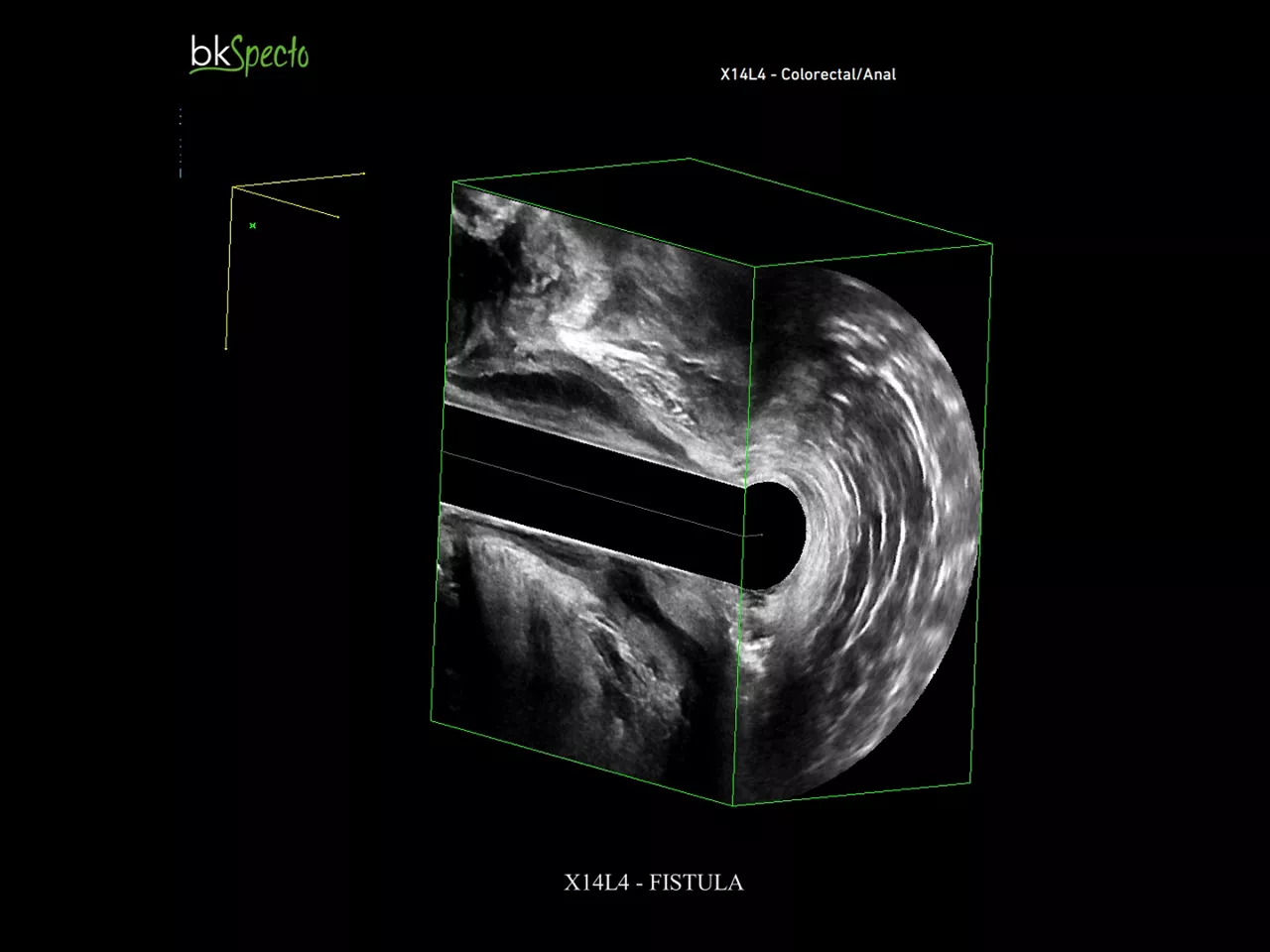 colorectal-surgery-imaging-desktop