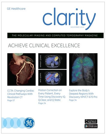 product-product-categories-computed-tomography-clarity magazine.png