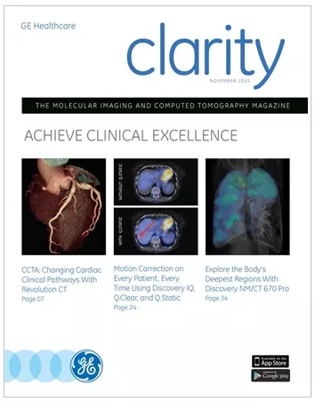 product-product-categories-computed-tomography-clarity magazine.png