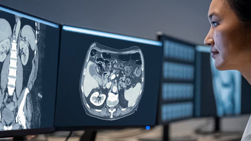 computed-tomography-feature-card-true-fidelity-ba-en