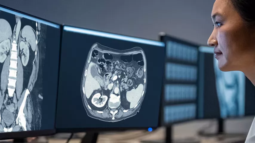 computed-tomography-feature-card-true-fidelity-ba-en