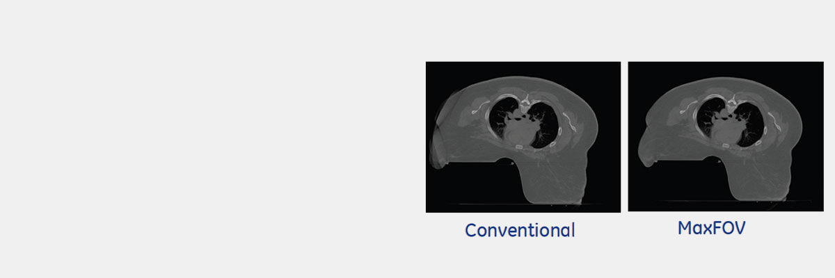product-product-categories-computed-tomography-radiation therapy-main.png
