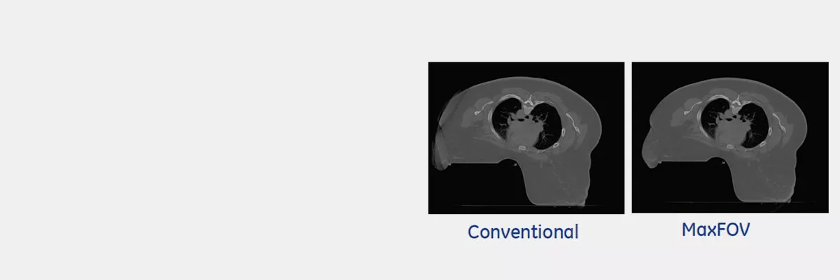 product-product-categories-computed-tomography-radiation therapy-main.png