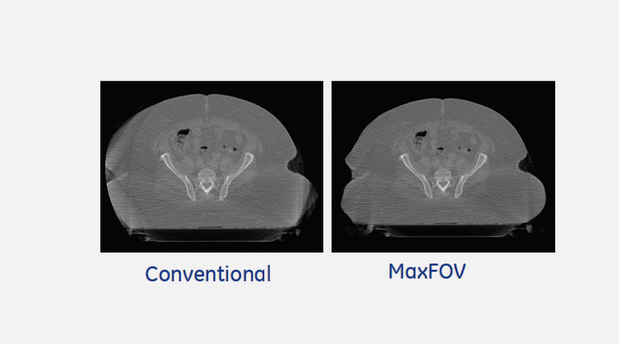 product-product-categories-computed-tomography-radiation therapy-new.png