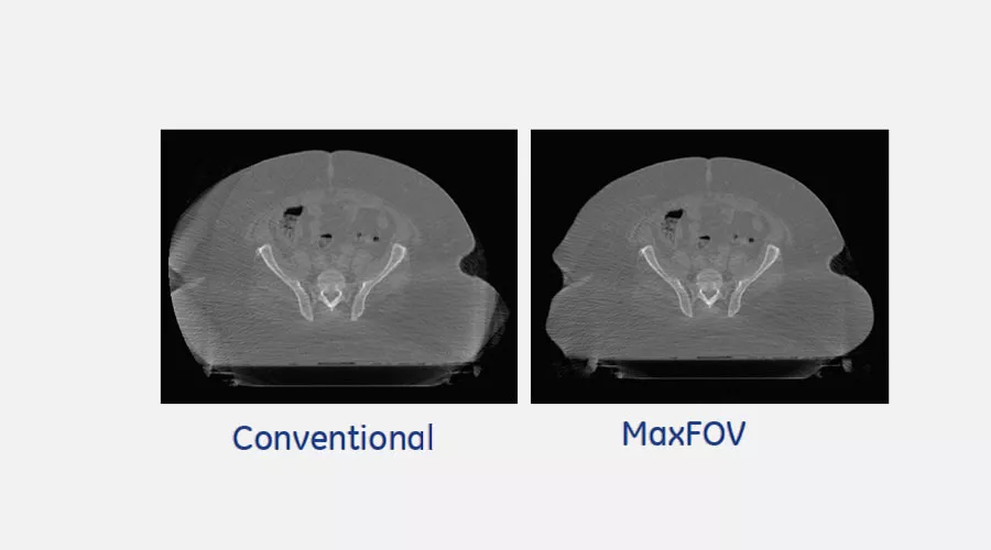 computed-tomography-radiationtherapy-new