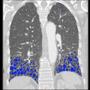 product-categories-computed-tomography-revolution ct-image gallery-top right image new.png