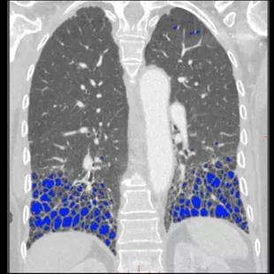 product-categories-computed-tomography-revolution ct-image gallery-top right image new.png