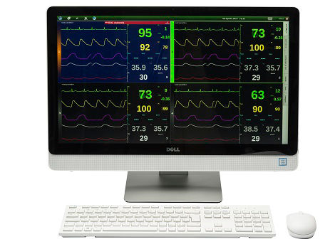 Configuraoes Flexiveis