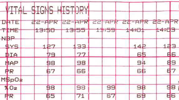 corometrics-250cx-vital-signs-data-st-en