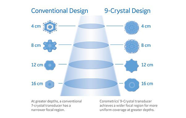 corometrics-crystal