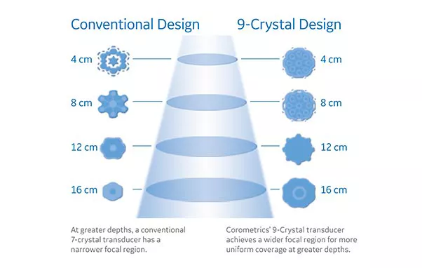 corometrics-crystal
