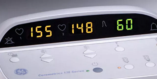 corometrics-monitoring-screen