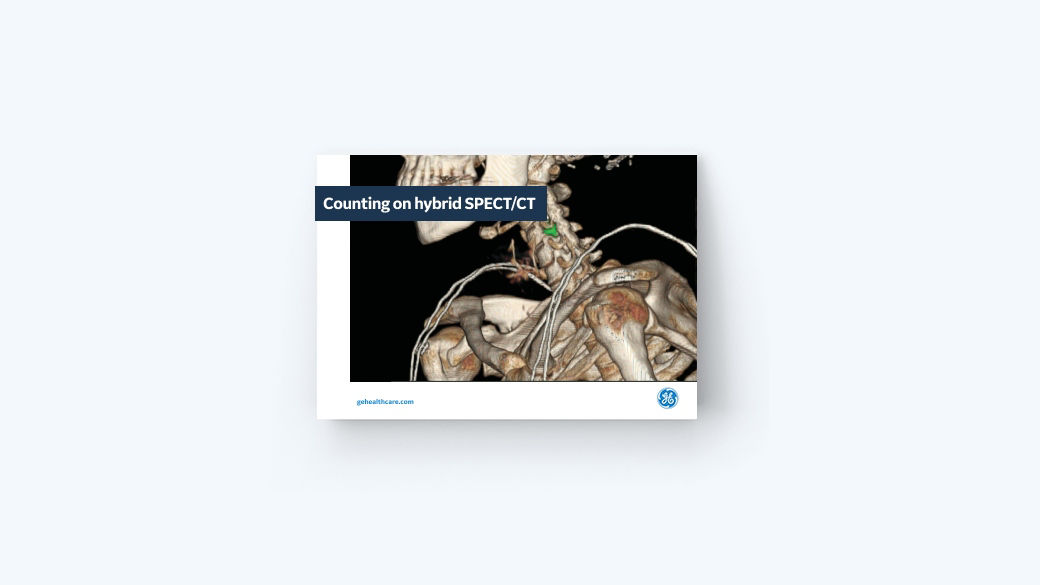 Counting on hybrid SPECT/CT for elevated diagnostic value in radiology