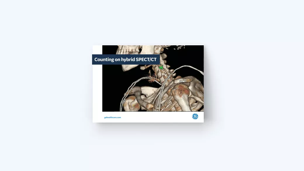 Counting on hybrid SPECT/CT for elevated diagnostic value in radiology
