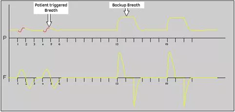 cpap