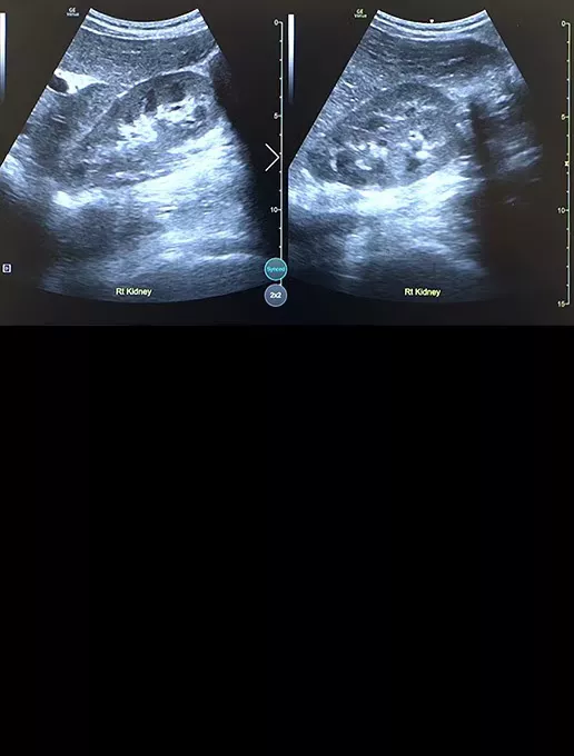 critical-care-follow-up-st-en